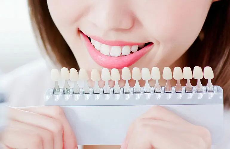 ホワイトニング