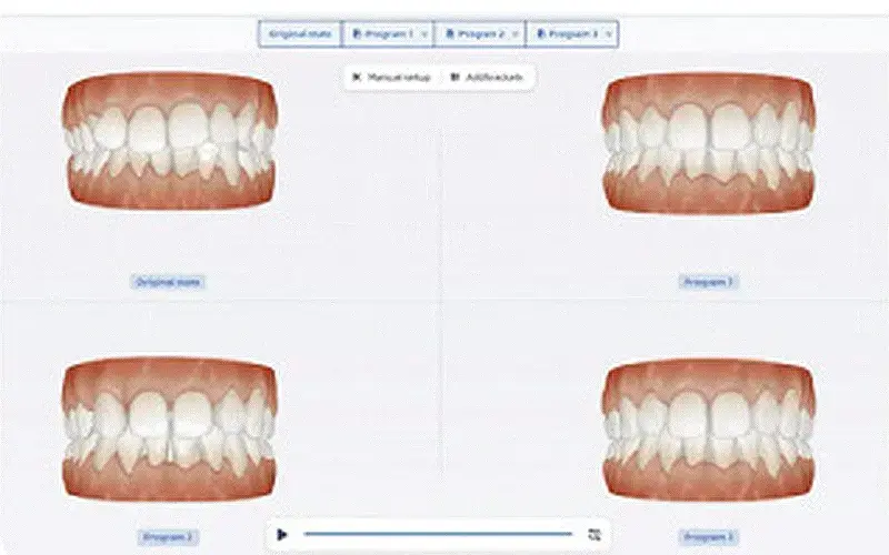 スピーディーに治療計画を立案