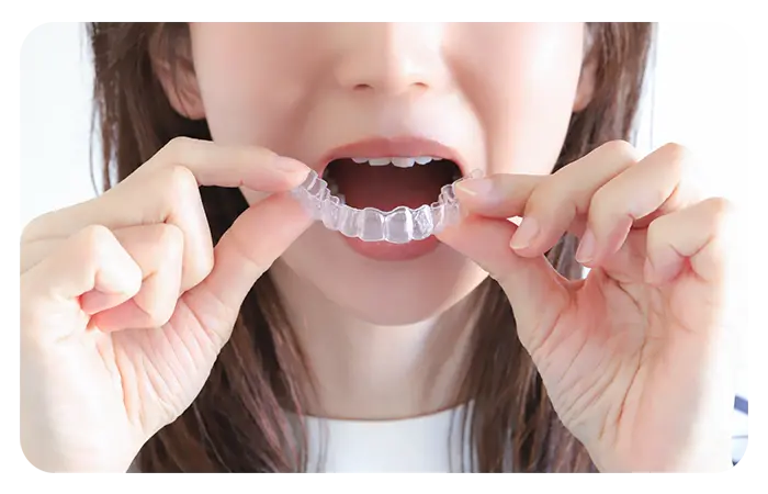 マウスピース矯正（エンジェルアライナー）