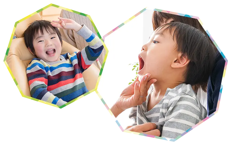 口腔筋機能療法（MFT）