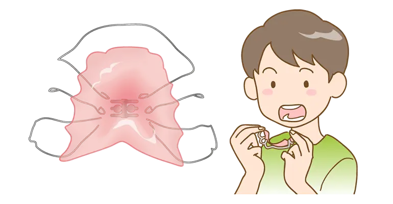 第１期矯正治療